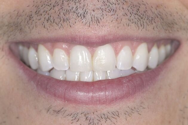 Smile Transformations: Case 3 - Before