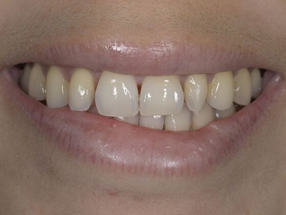 Smile Transformations: Case 6 - Before