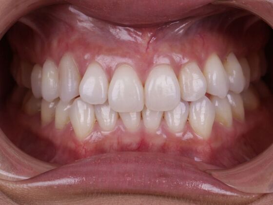 Smile Transformations: Case 5 - Before
