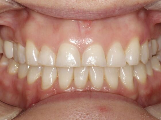 Smile Transformations: Case 2 - Before