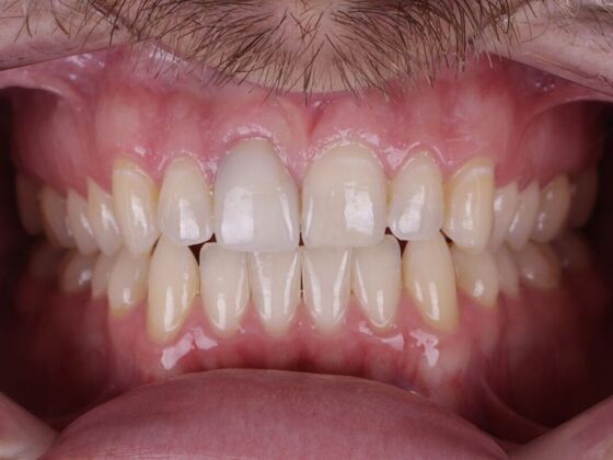 Smile Transformations: Case 1 - Before